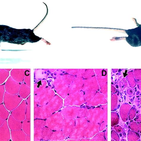 Immunofluorescent Staining Of Dystrophin A And B And Utrophin C And