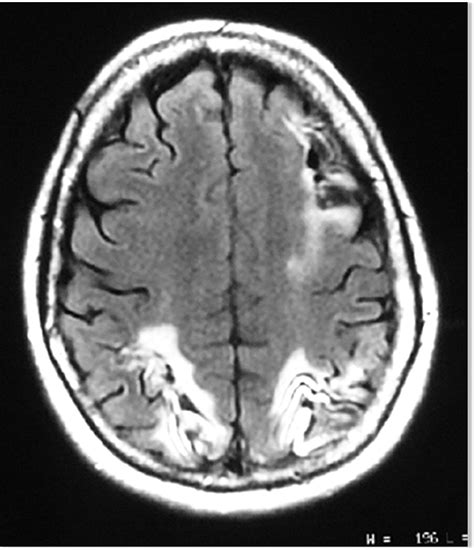 exceptional memory linked  bulked  parts  brain science