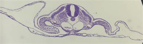 48 Hour Chick Embryo Cross Section Diagram Quizlet 60 OFF