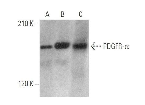 Pdgf Receptor Alpha Pdgfra C Scbt Santa Cruz Biotechnology