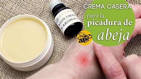 Remedio Natural Pomada Para Picudura De Insectos Crema Picadura