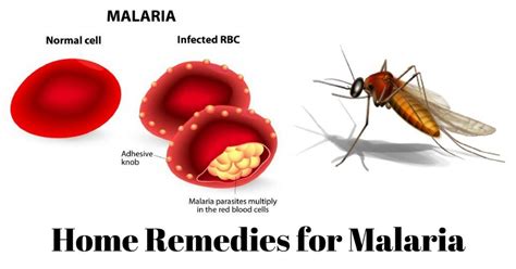 Malaria Treatment - Natural Home Remedies To Heal You Internally - Fitneass