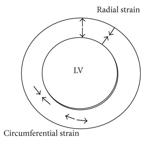radial strain  circumferential strain af radial strain