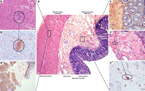 He Stained Section Of The Colon Showing The Histological Structure Of