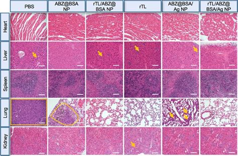 Histopathological Examination Of Major Organs Collected At The