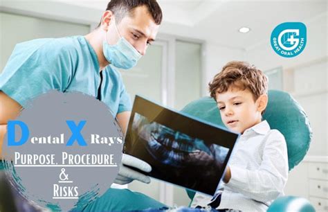 Dental X-Rays Purpose, Procedure, and Risks - GREAT ORAL HEALTH