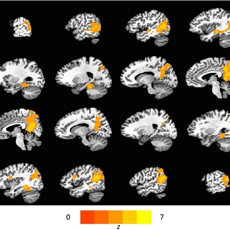 Brain Regions Involved In Memory Reinstatement Heatmap Shows Regions