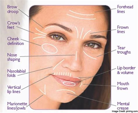 Nasolabial Folds Causes Symptoms Treatment And Prevention