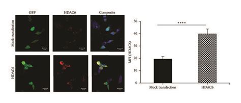 Hdac6 Protein Overexpression And Its Effect On Tubulin Acetylation In