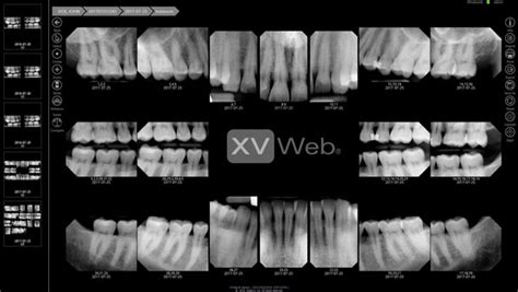 Dental Radiology Fmx