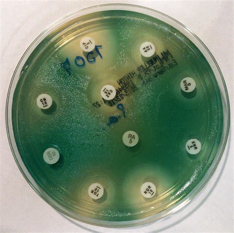 Gallery For > Pseudomonas Aeruginosa