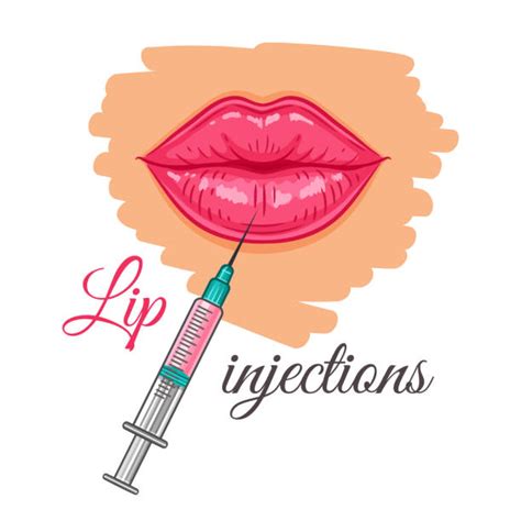 Efudex Treatment Pictures Lips Clipart