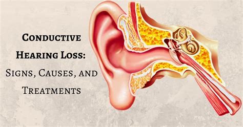 Conduction Hearing Loss