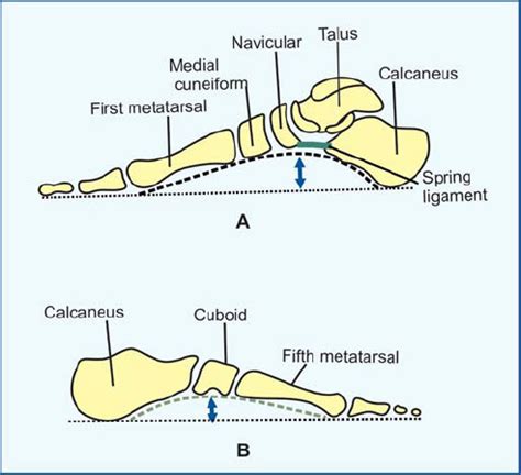 Medial Longitudinal Arch