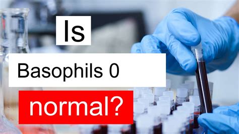 Is Basophils 0 normal, high or low? What does Basophils level 0 mean?