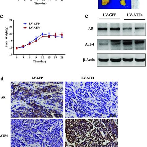 ATF4 Overexpression Inhibited Tumor Growth In A CAL 148 Cell Orthotopic