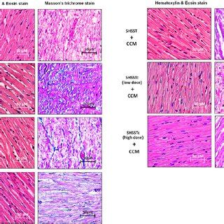 Morphology assessments by hematoxylin and eosin (H&E) stain, Massion’s ...