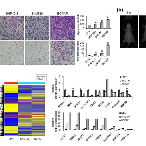 Characterization Of Papillary Thyroid Cell Lines For Metastatic