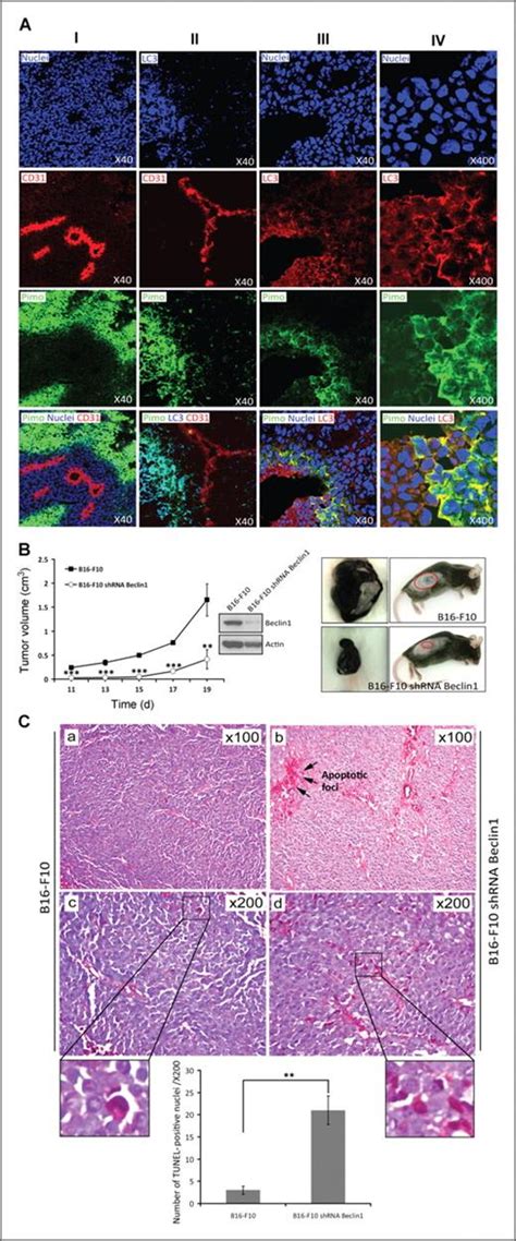 Blocking Hypoxia Induced Autophagy In Tumors Restores Cytotoxic T Cell