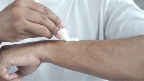 person  applying cream   arm  stock video  vecteezy