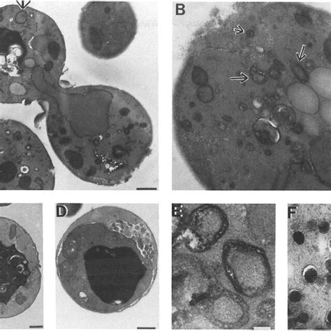 Quinacrine Accumulation In The Vacuoles Of Wild Type Cells And Vpt