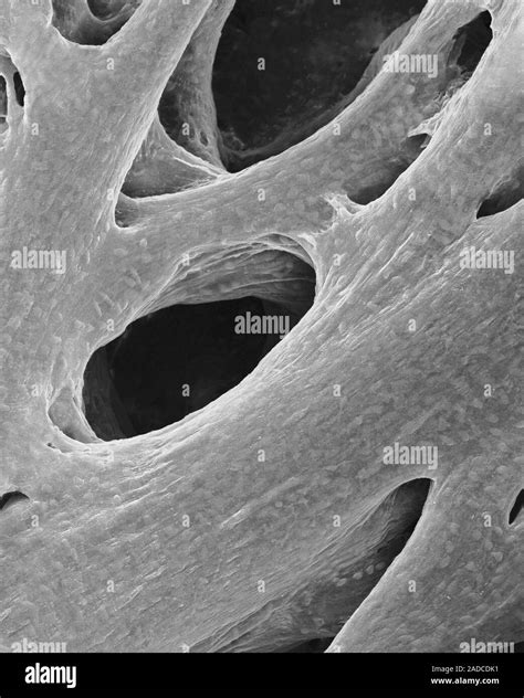 Heart Atrium Cardiac Muscle Bundles Mammal Scanning Electron