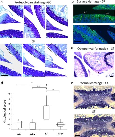 Articular Cartilage And Sternal Fibrocartilage Respond Differently To