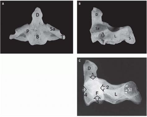 Cervical Spine Anatomy Radiology