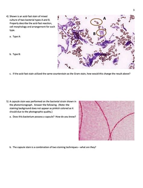 SOLVED 4 Shown Is An Acid Fast Stain Of Mixed Culture Of Two Bacterial