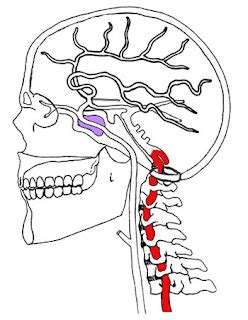 Physiotherapy Fitness Beauty: What is vertebrobasilar insufficiency