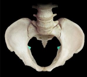 Ischial Spine - Images, What is, Causes, symptoms, Treatment