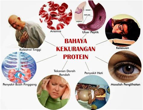 12 Tanda Kekurangan Protein Dalam Tubuh