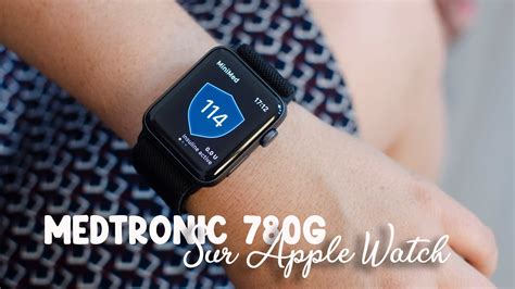 Medtronic G Sur Apple Watch Youtube