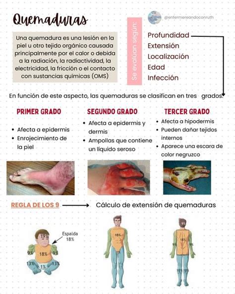 Quemaduras Enfermereando Con Ruth Udocz