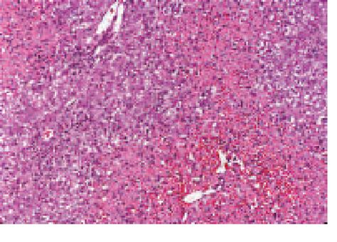 Table 1 From Disease Histological Patterns In Drug Induced Liver Semantic Scholar