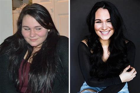 Weight Loss Woman Loses 6st After Surgery When She Was 16 ‘my