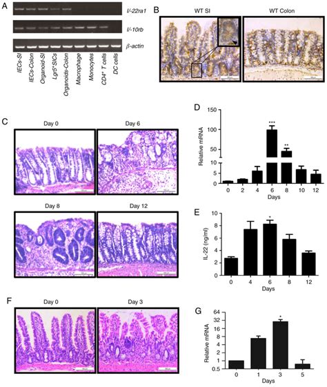 Interleukin22 Regulates The Homeostasis Of The Intestinal Epithelium