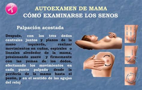 Autoexamen De La Mama PPT