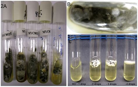 Microbial Culture Methods Boundless Microbiology