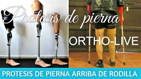 PRÓTESIS PARA AMPUTACIÓN ARRIBA DE RODILLA ORTHO LIVE YouTube