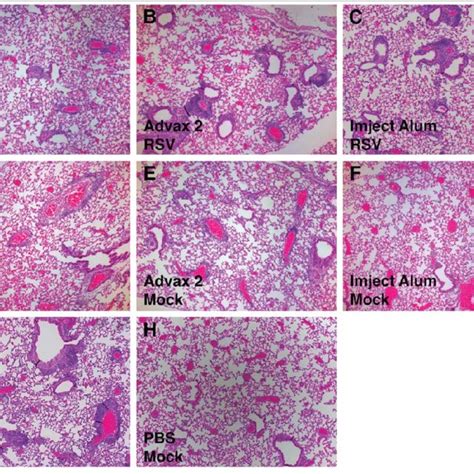 Histopathology Images Of Lungs After Rsv Challenge Balb C Mice Were