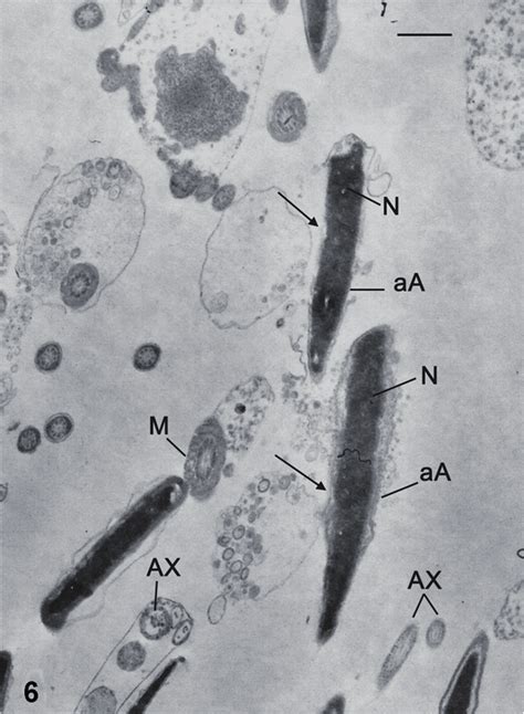 Transmission Electron Microscopy Micrograph Of Longitudinal And Cross