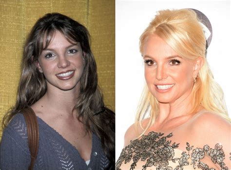 30 Celebrities Who Clearly Had Plastic Surgery Before And After Pics