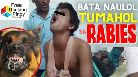 Ang Lalaki Na Parang Naging ASO Dahil Sa Rabies Nakakatakot Na Epekto