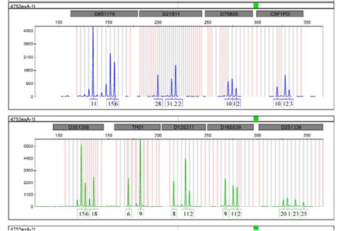 Importance Of Y STR Profiling In Sexual Assault Cases With Mixed DNA