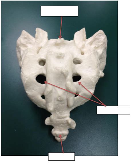 sacral anatomy Diagram | Quizlet