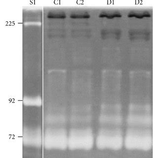 Sds Page Gelatin Zymography And Western Blotting After Gelatin Affinity