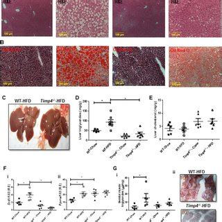 Timp4 Gene Deletion Protects Mice From HFD Induced Hepatic Steatosis H