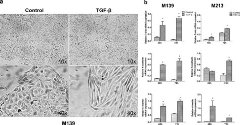 A Morphological Changes Of Tgf Induced Cells At H As Shown At