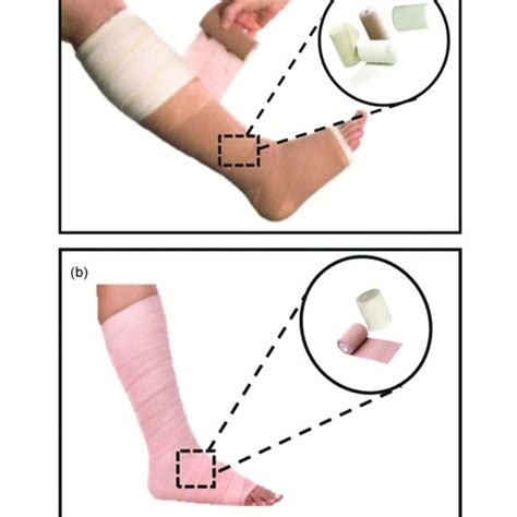 A Four Layer And B Two Layer Compression Bandage Components Download Scientific Diagram